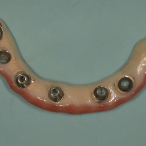 Implants10