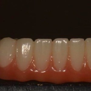 Implants11