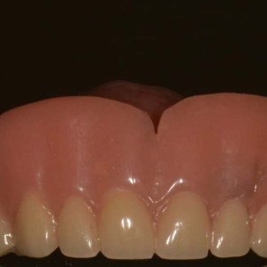 Implants12